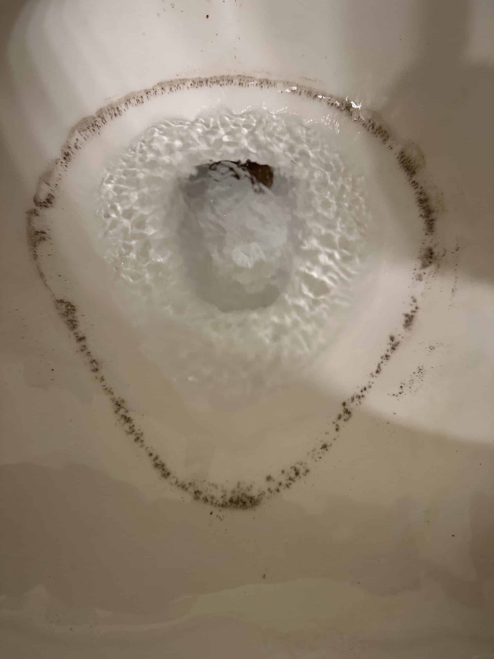 Black Ring In Toilet